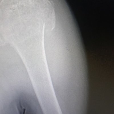 Dhara Xray.jpg