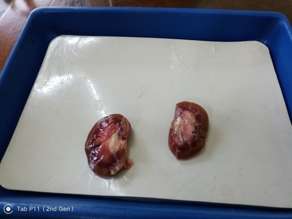 From Beans to Biology Our Kidney Dissection1.jpg
